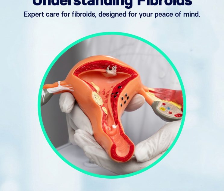 Understanding Fibriod